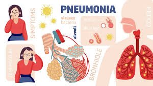 Pneumonia Penyakit Serius